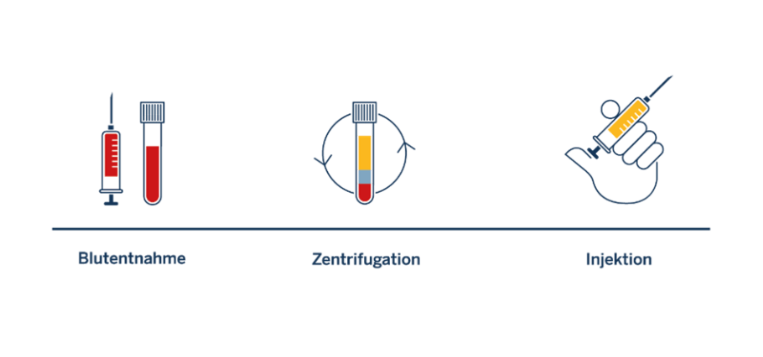 Drei farbige Piktogramme: Spritze mit rotem Inhalt, Zentrifugenröhrchen mit gelbem und rotem Inhalt, Hand hält Spritze mit gelber Flüssigkeit.